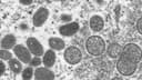 Monkeypox pandemic in 2024?